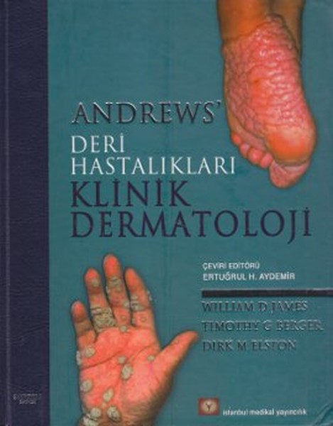 Andrews Deri Hastalıkları Klinik Dermatoloji